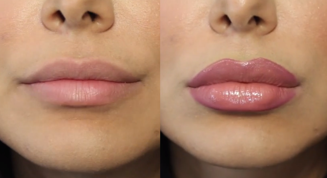 Top Mistakes We Make While Applying Lip MakeUp!